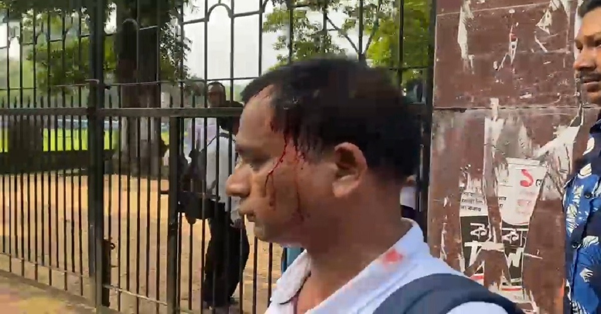 স্কুলে মধ্যাহ্নভোজে ছাত্রদের হাতে রক্তাক্ত প্রধান শিক্ষক!